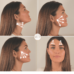 an example of how the 8-point facelift works