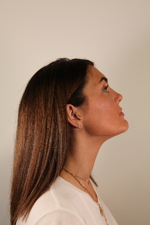 neck rejuvenation side profile