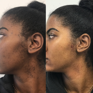 pigment before and after work
