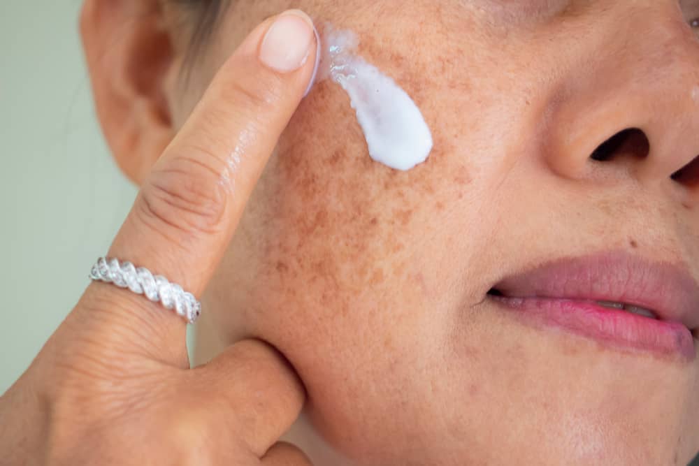 pigmentation skincare treatment
